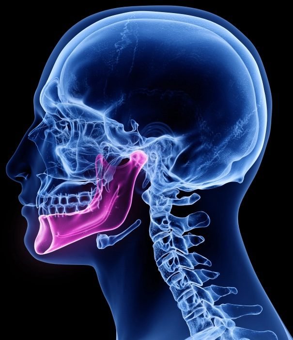 dolor mandibular, osteoartritis de atm